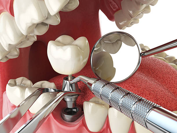 Best Emergency Dental Extractions in Jesup, IA